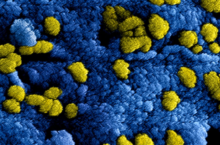 nieuw_coronavirus_in_china